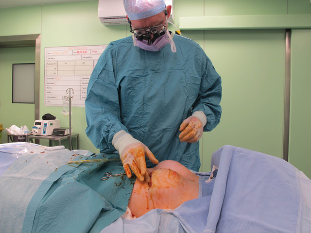 Breast surgery in progress